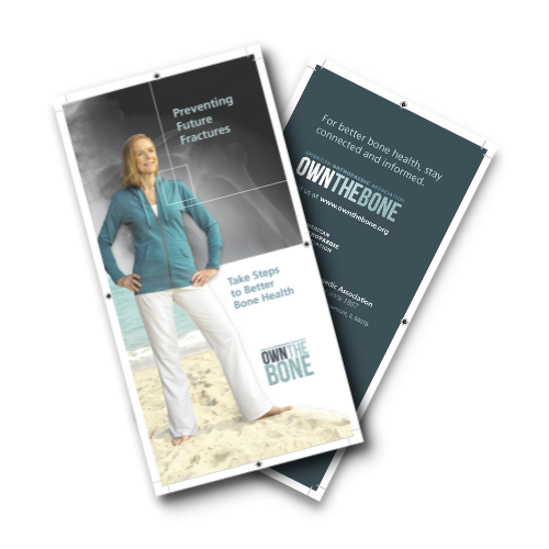 Customized Print Ready Own the Bone Patient Brochure